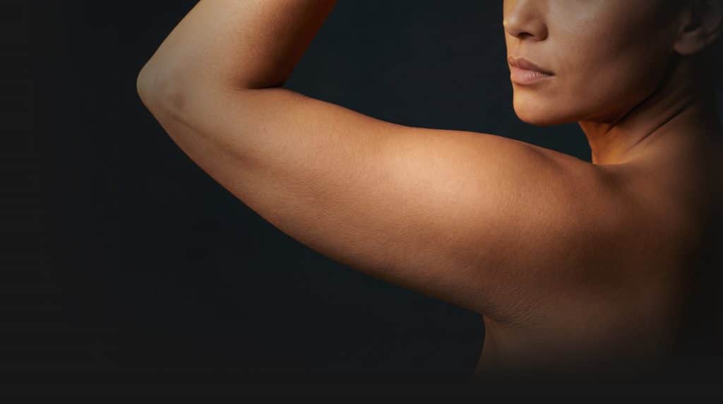Female upper arm showing loose skin suitable for arm lift surgery at Transform Beverly Hills