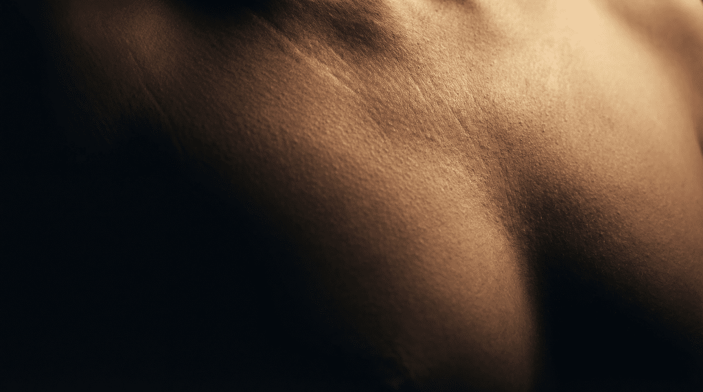 Close-up of female breast area showing stretch marks relevant to nipple correction surgery at Transform Beverly Hills