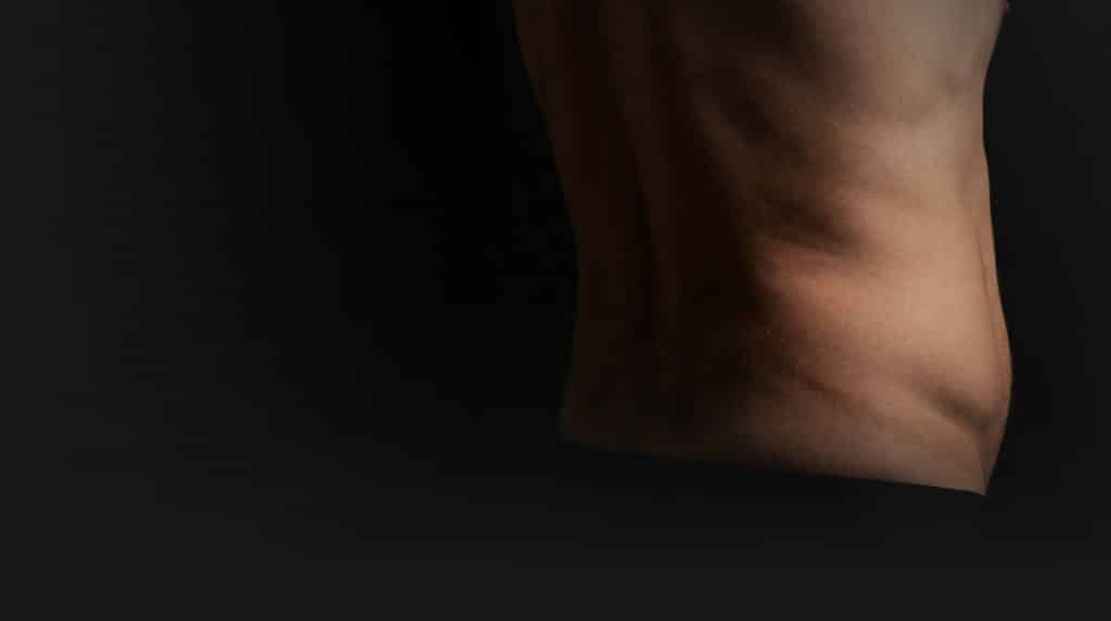 Male abdominal and flank area treated with liposuction at Transform Beverly Hills