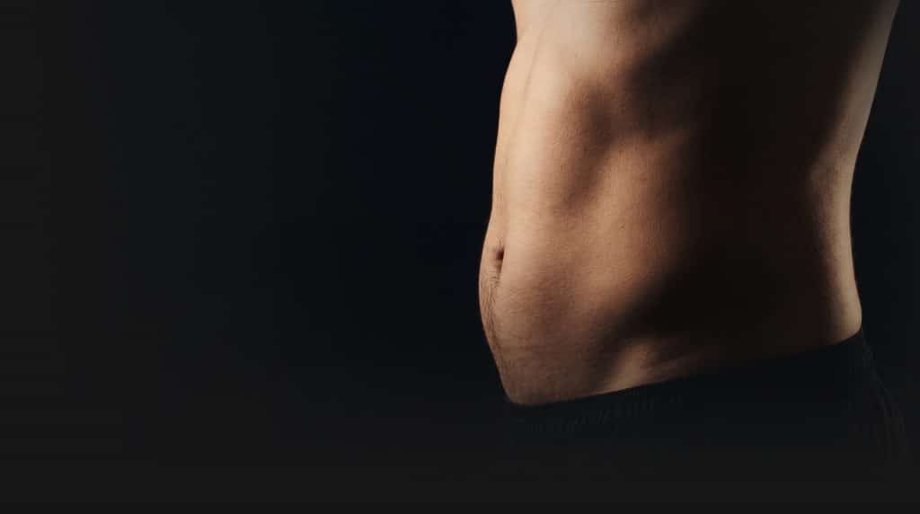 Male abdomen showing excess skin and fat suitable for tummy tuck surgery